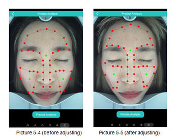Medizinischer Analysator-Digital-Gesichtsanalyse-System CER der Haut-3D bestätigt