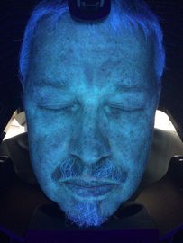 Berufs-Haut-Hydratations-Analysator der Falten-3D mit 18 Megapixel dem Pixel