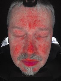 Gesichtshaut-Scanner-Analyse, Haut-Analysator-Maschine mit Cer-Zertifikat