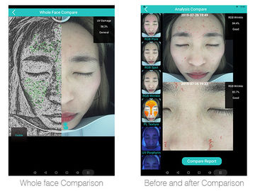 Intelligentes Problem des Haut-Analysator-12skin ermittelt mit Tablet 20 Million Pixel