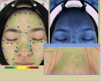 Berufs-Gesichtshydratations-Analysator-Maschine der haut-3d mit Touch Screen