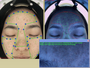 Pixel FCC der Feuchtigkeits-Analysator-Gesichts-Kamera-20Mega bescheinigen