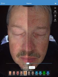 Gesichts-Analysator-Scanner Visia 32gb der Haut-3d Speicher für Doktor Skin Clinic