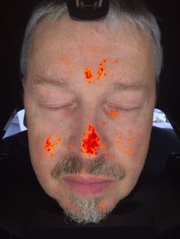 Haut-Analysator-magische Spiegel-Prüfvorrichtung 3D Digital für kosmetische Therapeut-Klinik