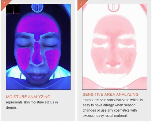 Intelligente Quizen der Skincare-Falten-Pigmentations-Akne-Haut-Analysator-Maschinen-3D