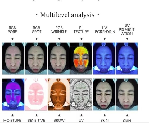 UVpl Android Berufshaut-Analysator 15MP Facial Camera RGB