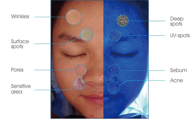 Tragbarer intelligenter Spiegel-Körper-Scanner-Haut-Analysator für Haut-Klinik/Schönheits-Salon