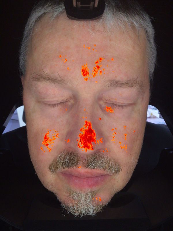 intelligente Scanner-Analyse-Digitalkamera-magisches Spiegel-System der Haut-3D für Verkauf