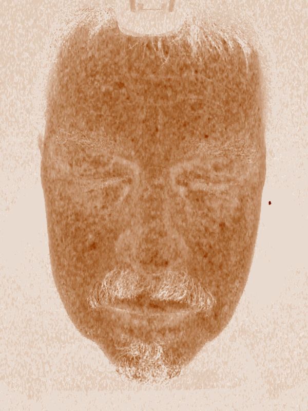 Hochauflösendes Scanner-Analyse-System der Haut-5d, empfindliche Haut-Analysator für Salone-Badekurort