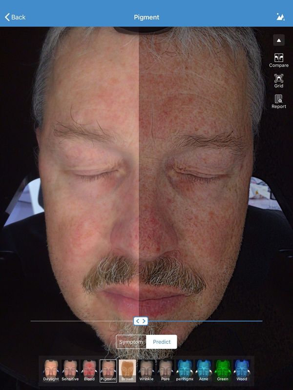 Gesichts-Analysator-Scanner Visia 32gb der Haut-3d Speicher für Doktor Skin Clinic
