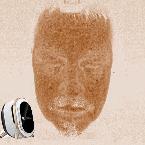 Professioneller tragbarer Haut-Analysator, Gesichtsspannung haut Analyse-110-220V